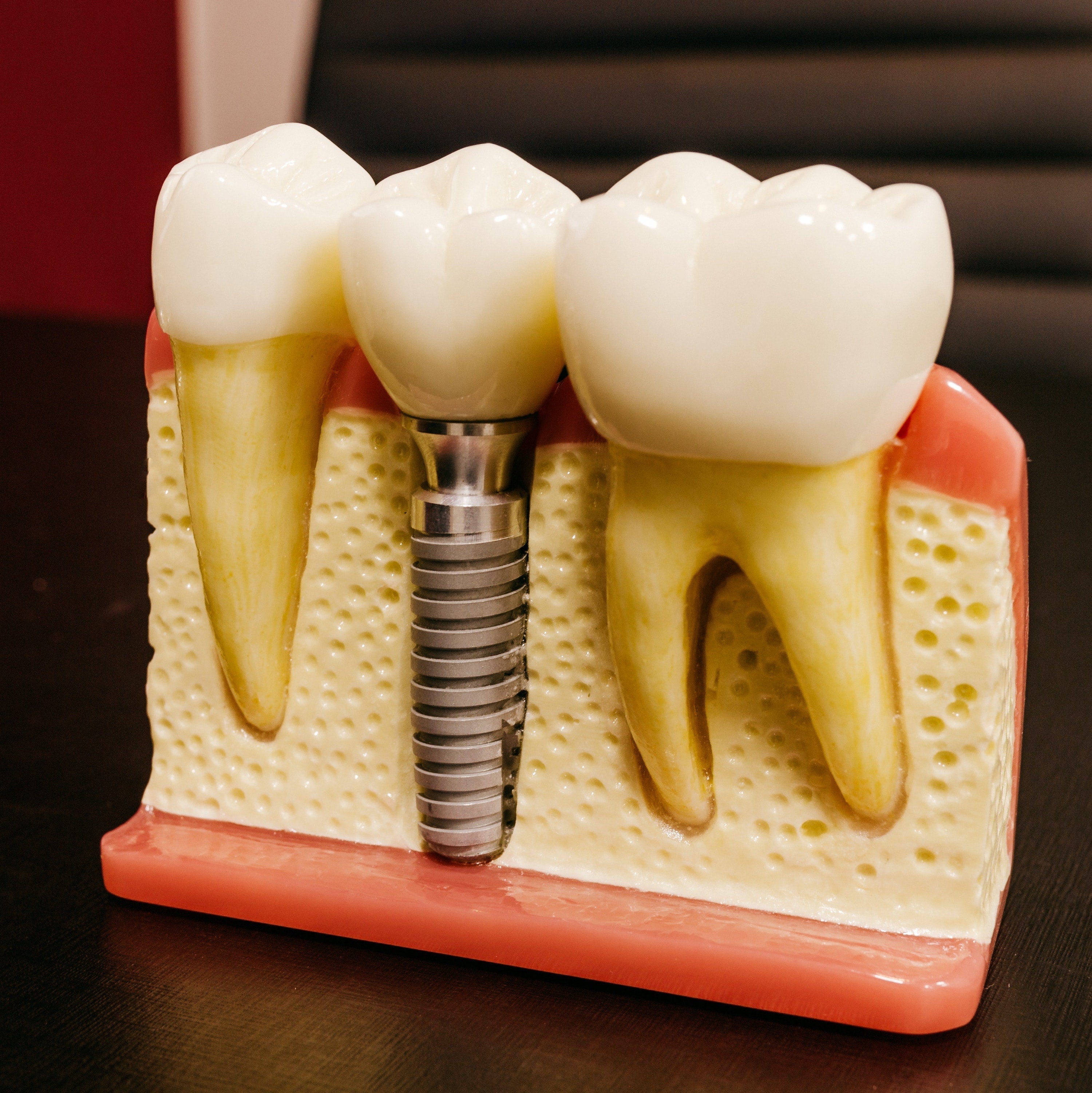 Are Zima Dental's Ultrasonic Boosting tablets compatible with cobalt chromium dental appliances? (2026) - Dr. Jack Pinnar-Smith