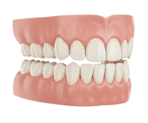 Dentures